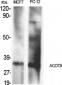 ACOT8 Polyclonal Antibody