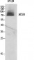 ACSS1 Polyclonal Antibody