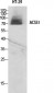 ACSS1 Polyclonal Antibody