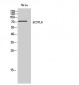 ACSVL6 Polyclonal Antibody