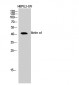 Actin α1 Polyclonal Antibody