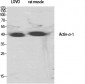 Actin α1 Polyclonal Antibody