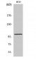 Actinin-α3 Polyclonal Antibody