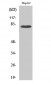 Adducin γ Polyclonal Antibody