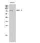 AKAP 10 Polyclonal Antibody