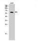 Akt Polyclonal Antibody