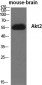 Akt2 Polyclonal Antibody
