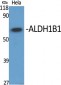 ALDH1B1 Polyclonal Antibody