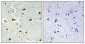 Aldolase B Polyclonal Antibody