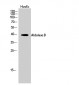 Aldolase B Polyclonal Antibody