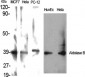 Aldolase B Polyclonal Antibody