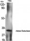 Aldose Reductase Polyclonal Antibody