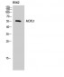 ALK-1 Polyclonal Antibody