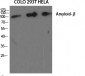 Amyloid-β Polyclonal Antibody