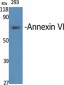 Annexin VI Polyclonal Antibody