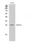 APOBEC3A Polyclonal Antibody