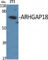 ARHGAP18 Polyclonal Antibody