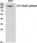 ATP-citrate synthase Polyclonal Antibody