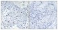 BAF250b Polyclonal Antibody