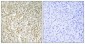 BARD1 Polyclonal Antibody