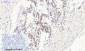 Bcl-2 Polyclonal Antibody