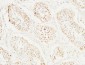 BM28 Polyclonal Antibody