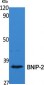 BNIP-2 Polyclonal Antibody