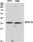 BRAF35 Polyclonal Antibody