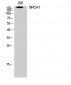 BRCA1 Polyclonal Antibody