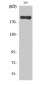 BRCA1 Polyclonal Antibody