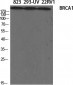 BRCA1 Polyclonal Antibody