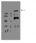 BRCA1 Polyclonal Antibody