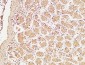 BRCA1 Polyclonal Antibody