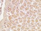 BRCA1 Polyclonal Antibody