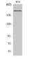 BRCA1 Polyclonal Antibody