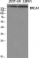 BRCA1 Polyclonal Antibody