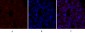 BRCA1 Polyclonal Antibody