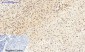 C/EBP β Polyclonal Antibody