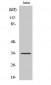 C/EBP ε Polyclonal Antibody