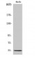 C1INH Polyclonal Antibody