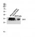 CA II Polyclonal Antibody