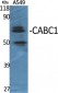 CABC1 Polyclonal Antibody