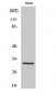 Carbonyl Reductase 3 Polyclonal Antibody