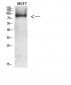 Catenin-β Polyclonal Antibody