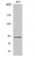 Catenin-β Polyclonal Antibody