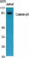 Catenin-β1 Polyclonal Antibody