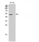 CB1 Polyclonal Antibody