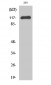 Cbl Polyclonal Antibody