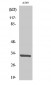 CD20 Polyclonal Antibody