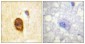 CD4 Polyclonal Antibody